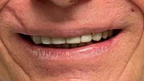 R.G. before smile