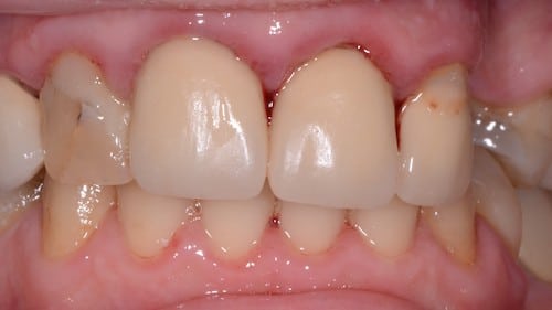 patient 1 before