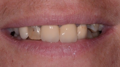 patient 2 before